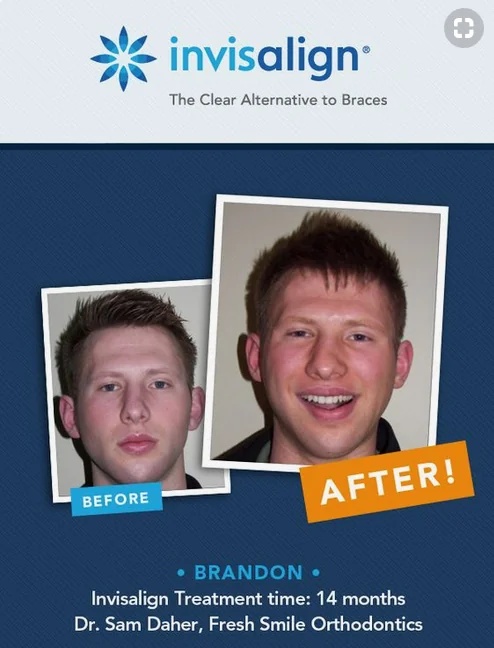 Before & After ad example